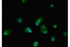 Immunofluorescent analysis of MCF-7 cells using ABIN7145812 at dilution of 1:100 and Alexa Fluor 488-congugated AffiniPure Goat Anti-Rabbit IgG(H+L) (BRD4 anticorps  (AA 150-200))