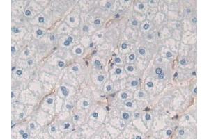 Detection of GKN1 in Human Liver Tissue using Polyclonal Antibody to Gastrokine 1 (GKN1)