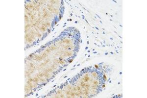 Immunohistochemistry of paraffin-embedded human rectum using ST antibody (ABIN6128538, ABIN6148573, ABIN6148574 and ABIN6222755) at dilution of 1:100 (40x lens). (STAT4 anticorps  (AA 569-748))