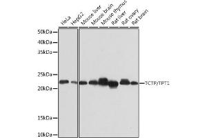 Western blot analysis of extracts of various cell lines, using TCTP/TPT1 Rabbit mAb (ABIN7271101) at 1:1000 dilution. (TPT1 anticorps)
