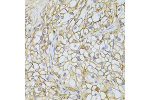 Immunohistochemistry of paraffin-embedded human kidney using BSG Antibody (ABIN5970747) at dilution of 1/200 (40x lens).