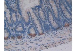 DAB staining on IHC-P; Samples: Rat Intestine Tissue (Osteopontin anticorps  (AA 17-317))