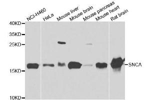 Western blot analysis of extracts of various cell lines, using SNCA antibody. (SNCA anticorps  (AA 61-140))