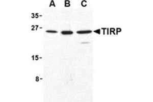 Western blot analysis of TIRP in human (A), mouse (B), and rat (C) kidney cell lysates with this product at 1 μg/ml. (TICAM2 anticorps  (C-Term))