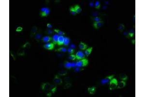 Immunofluorescence staining of PC-3 cells with ABIN7166152 at 1:266, counter-stained with DAPI. (SPRY4 anticorps  (AA 1-299))