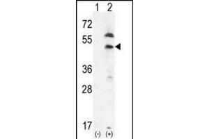 Western blot analysis of PDGFRL (arrow) using rabbit polyclonal PDGFRL- (ABIN392037 and ABIN2841805). (PDGFRL anticorps  (C-Term))