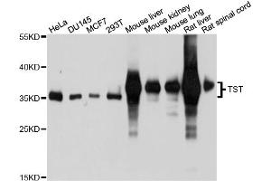 Western blot analysis of extracts of various cell lines, using TST antibody (ABIN4905513) at 1:1000 dilution. (TST anticorps)