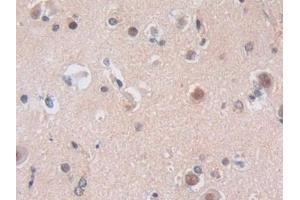 Detection of NUP50 in Human Cerebrum Tissue using Polyclonal Antibody to Nucleoporin 50 kDa (NUP50)