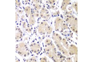 Immunohistochemistry of paraffin-embedded human gastric using CHEK1 antibody at dilution of 1:100 (x40 lens). (CHEK1 anticorps)