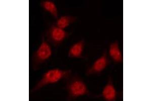 ABIN6267454 staining K562 by IF/ICC. (MKP-1/2 anticorps  (pSer296, pSer318))