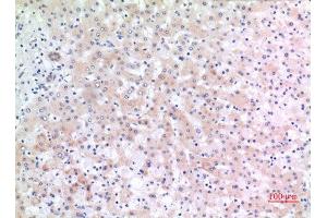 Immunohistochemistry (IHC) analysis of paraffin-embedded Human Liver, antibody was diluted at 1:100. (CD166 anticorps  (C-Term))