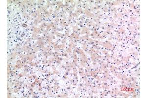 Immunohistochemistry (IHC) analysis of paraffin-embedded Human Liver, antibody was diluted at 1:100.
