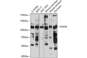 Western blot analysis of extracts of various cell lines, using SOX30 antibody (ABIN6131031, ABIN6148300, ABIN6148302 and ABIN6215454) at 1:1000 dilution. (SOX30 anticorps  (AA 1-150))