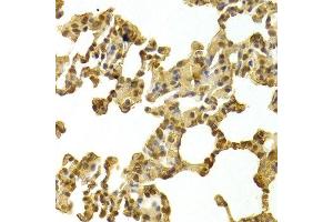 Immunohistochemistry of paraffin-embedded rat lung using CDK4 Antibody.