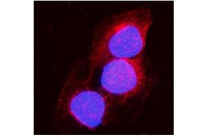IF analysis of Aconitase 1/ACO1 using anti-Aconitase 1/ACO1 antibody (ABIN7598988). (Aconitase 1 anticorps  (AA 1-137))
