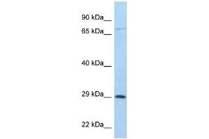 Western Blot showing F11R antibody used at a concentration of 1 ug/ml against 721_B Cell Lysate (F11R anticorps  (C-Term))