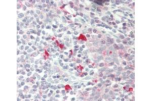 Formalin-fixed and paraffin-embedded H.