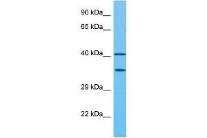 Host:  Rabbit  Target Name:  PAX2  Sample Tissue:  Human Ovary Tumor  Antibody Dilution:  1ug/ml (PAX2A anticorps  (Middle Region))