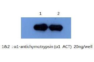 Western Blotting (WB) image for anti-serpin Peptidase Inhibitor, Clade A (Alpha-1 Antiproteinase, Antitrypsin), Member 3 (SERPINA3) antibody (ABIN1105309) (SERPINA3 anticorps)