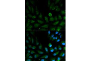 Immunofluorescence analysis of HepG2 cells using CAPZA2 antibody. (CAPZA2 anticorps)