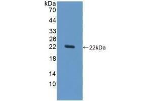 Detection of Recombinant SOD1, Equine using Polyclonal Antibody to Superoxide Dismutase 1 (SOD1) (SOD1 anticorps  (AA 2-154))