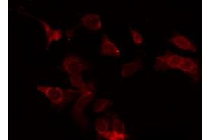 ABIN6273946 staining Hela by IF/ICC. (LGR5 anticorps  (Internal Region))