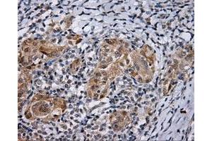 Immunohistochemical staining of paraffin-embedded Kidney tissue using anti-LIPG mouse monoclonal antibody. (LIPG anticorps)