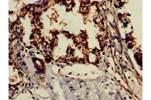 Immunohistochemistry of paraffin-embedded human lung tissue using ABIN7147139 at dilution of 1:100 (ITGB1 anticorps  (AA 297-380))