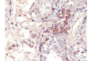 Formalin-fixed, paraffin-embedded human Testicular Carcinoma stained with MAGE-1 Mouse Monoclonal Antibody (MA454). (MAGEA1 anticorps)