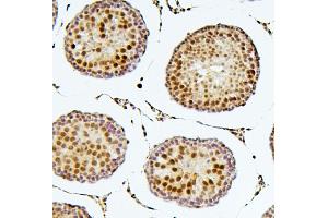 IHC analysis of SOX15 using anti-SOX15 antibody (ABIN6719624). (SOX15 anticorps  (AA 1-233))