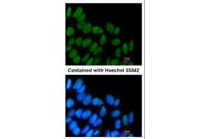Immunofluorescence (IF) image for anti-SRY (Sex Determining Region Y)-Box 2 (SOX2) antibody (ABIN2855074)