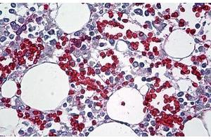 Human Bone Marrow: Formalin-Fixed, Paraffin-Embedded (FFPE) (Red Blood Cell anticorps)