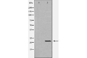 Western blot analysis of extracts of mouse livertissue, using IFNA1 antibody. (IFNA1 anticorps  (Internal Region))