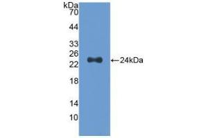 Western blot analysis of recombinant Human Slit2. (SLIT2 anticorps  (AA 1160-1333))