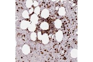 Immunohistochemical staining of human bone marrow with RESP18 polyclonal antibody ( Cat # PAB28328 ) shows strong nuclear and cytoplasmic positivity in hematopoietic cells at 1:50 - 1:200 dilution. (RESP18 anticorps)