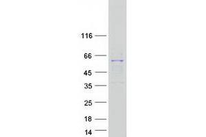 Validation with Western Blot