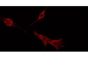 ABIN6276222 staining  MCF7 cells by IF/ICC. (TAS2R16 anticorps  (Internal Region))