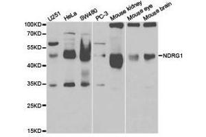 Western Blotting (WB) image for anti-N-Myc Downstream Regulated 1 (NDRG1) antibody (ABIN1873849)