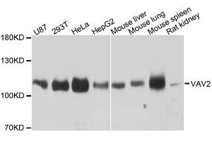 Western blot analysis of extracts of various cell lines, using VAV2 antibody. (VAV2 anticorps  (AA 570-700))