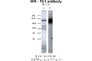 Image no. 2 for anti-Transglutaminase 1, Keratinocyte (TGM1) antibody (ABIN347015) (TGM1 anticorps)