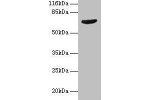 Western blot All lanes: GRK4 antibody at 2 μg/mL + Jurkat whole cell lysate Secondary Goat polyclonal to rabbit IgG at 1/10000 dilution Predicted band size: 67, 64, 58, 62 kDa Observed band size: 67 kDa (GRK4 anticorps  (AA 1-245))