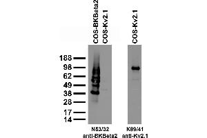 Immunoblot against extracts of COS cells transiently transfected with GFP-tagged BKBeta2 or untagged Kv2.