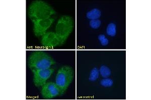 ABIN185446 Immunofluorescence analysis of paraformaldehyde fixed U2OS cells, permeabilized with 0. (Neuroligin 1 anticorps  (Internal Region))