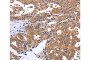Immunohistochemistry (IHC) image for anti-Gem (Nuclear Organelle) Associated Protein 2 (GEMIN2) antibody (ABIN1872798) (SIP1 anticorps)