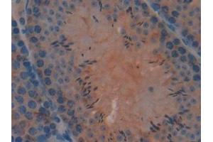 Detection of Grb7 in Mouse Testis Tissue using Polyclonal Antibody to Growth Factor Receptor Bound Protein 7 (Grb7)