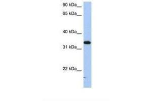 anti-Sulfotransferase Family, Cytosolic, 6B, Member 1 (SULT6B1) (AA 182-231) antibody