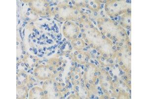 Immunohistochemistry of paraffin-embedded Rat kidney using CCL26 Polyclonal Antibody at dilution of 1:200 (40x lens). (CCL26 anticorps)
