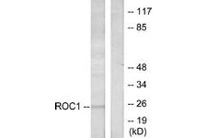 Western blot analysis of extracts from Jurkat cells, using RIT1 Antibody. (RIT1 anticorps  (AA 170-219))