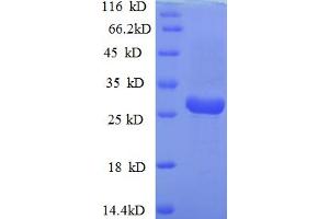 VacA (AA 1076-1290), (partial) protein (His tag)