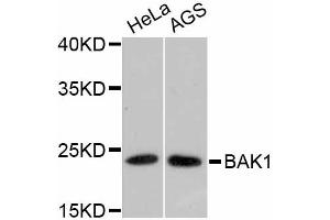 Western blot analysis of extracts of various cell lines, using BAK1 antibody (ABIN4903006). (BAK1 anticorps)